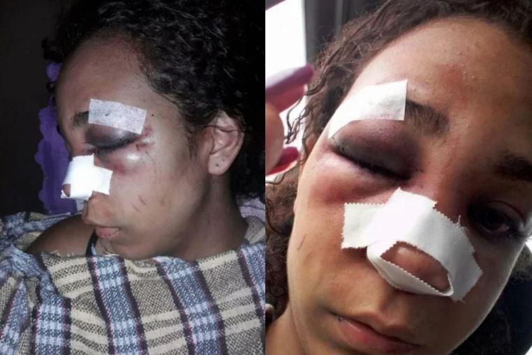 Mulher é agredida pelo ex-marido com martelo na frente da filha