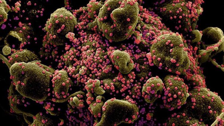 Imagens mostram células humanas sob ataque do novo coronavírus