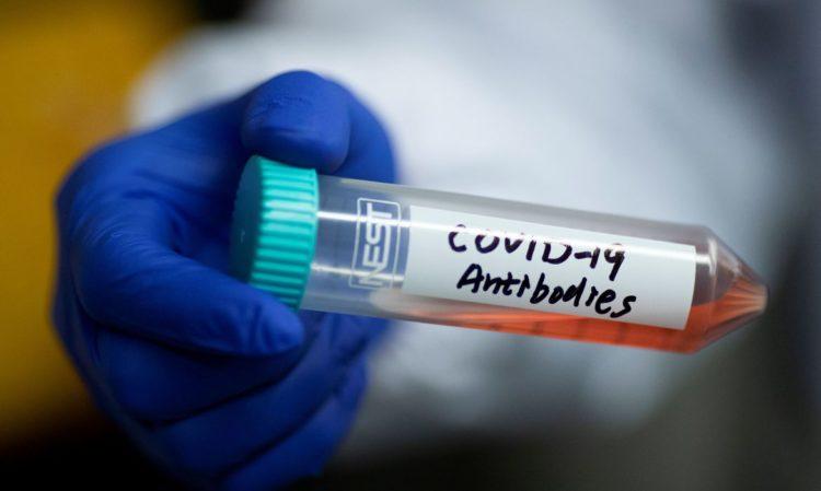 Brasil chega a 823 mortos e mais de 16 mil casos confirmados da doença