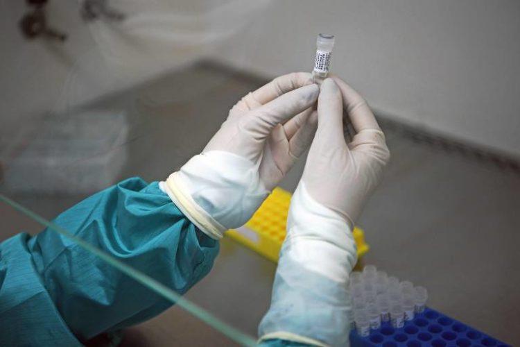 Brasil tem 615 mortes por Covid-19 em 24 horas e chega a 8.536; casos são 125.218