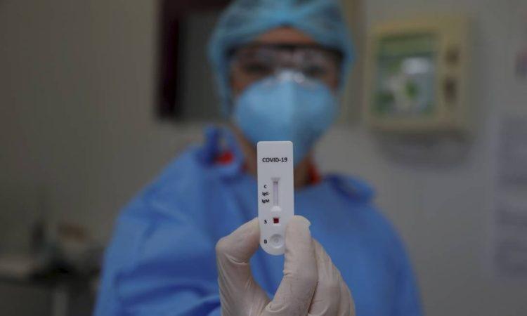 Brasil tem 7.288 mortes e 105.222 casos confirmados de novo coronavírus