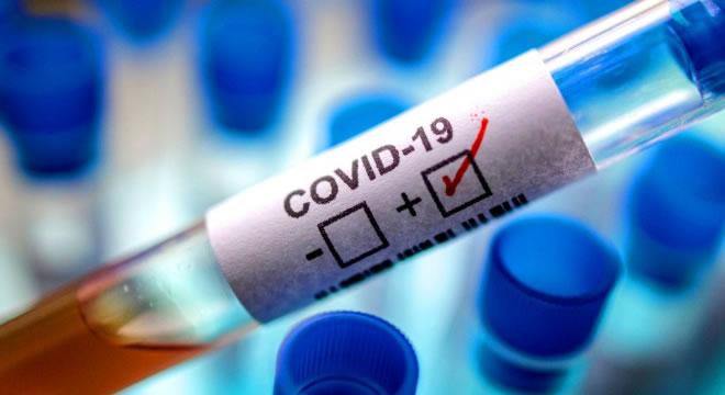 Ceará registra 1.189 óbitos por Covid-19, com mais de 17,5 mil casos confirmados