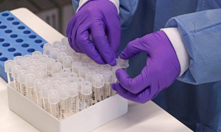 Covid: RN registra 12 óbitos em 24h e número total de mortes sobe para 160