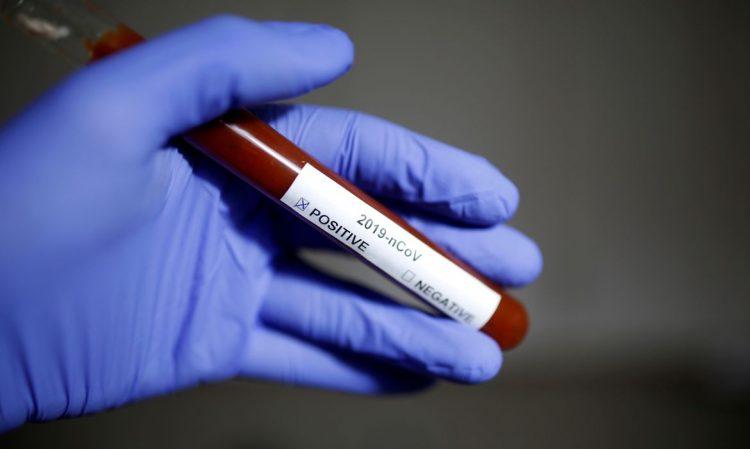 Natal contabiliza 20 mortos por Covid-19; total de óbitos no RN sobe para 85