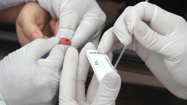RN contabiliza 626 mortes por Covid-19; outras 129 estão em investigação