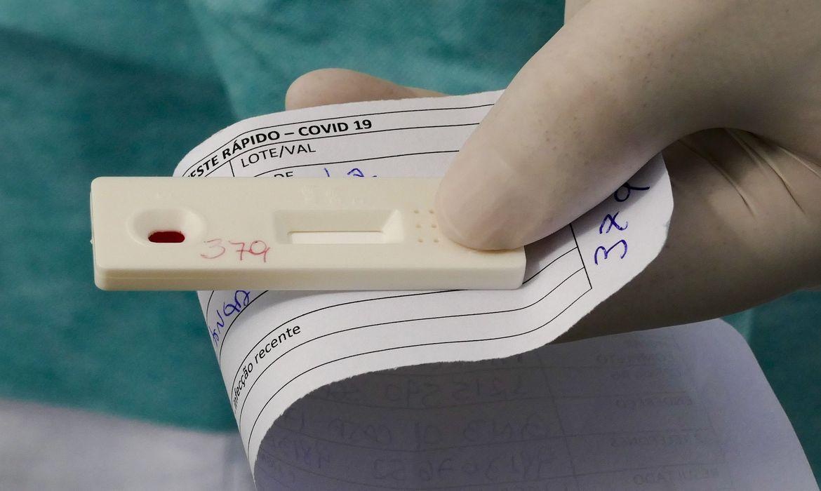 Covid-19: Brasil chega a 2 milhões de casos e tem mais de 76 mil óbitos