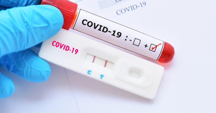 Covid-19: RN soma 1.344 óbitos e 37.046 casos confirmados, diz Sesap