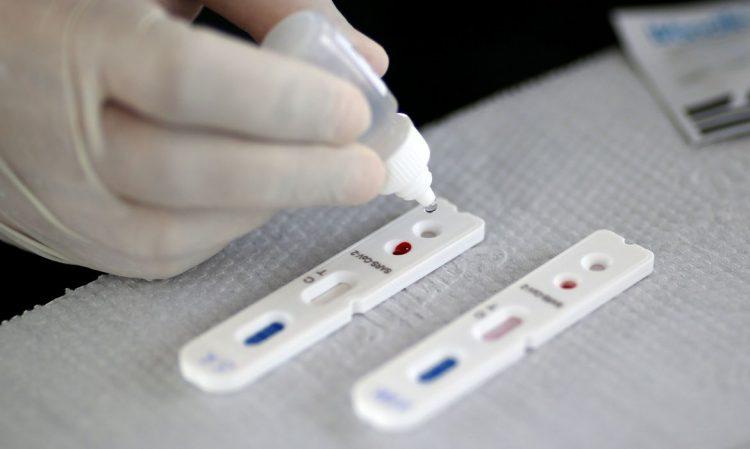Justiça derruba liminar que obrigava convênios a cobrirem o teste da Covid-19