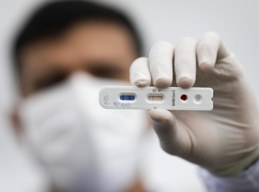 Redes de farmácias fazem 196,5 mil testes de covid-19 e 15% dão positivo