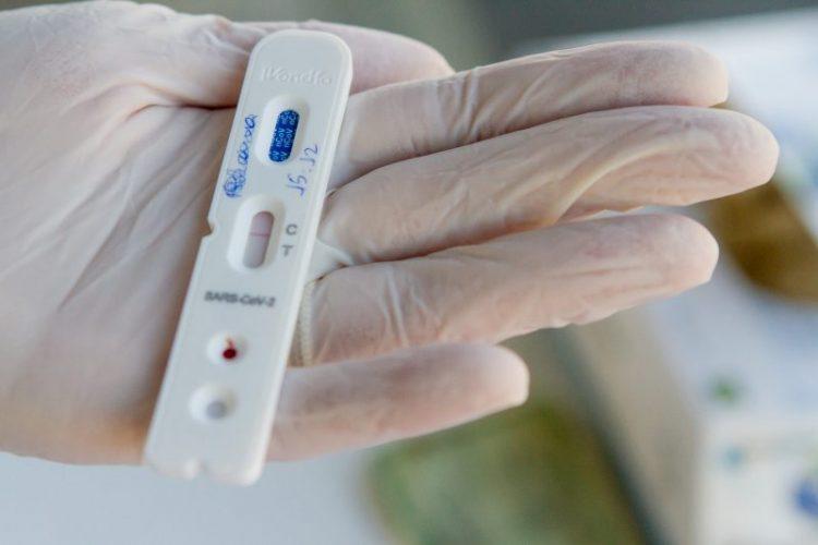 RN tem 32.578 casos de Covid-19 e 1.095 mortes em função da doença