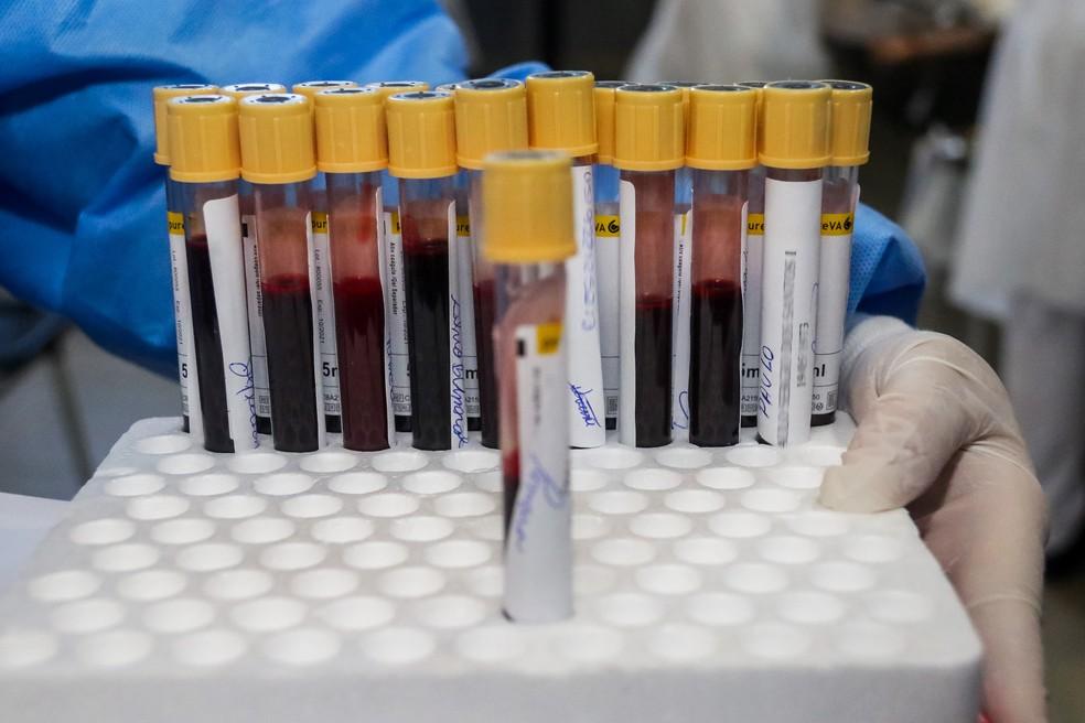 RN tem 49.667 casos confirmados de Covid-19 e 1.751 mortes pela doença