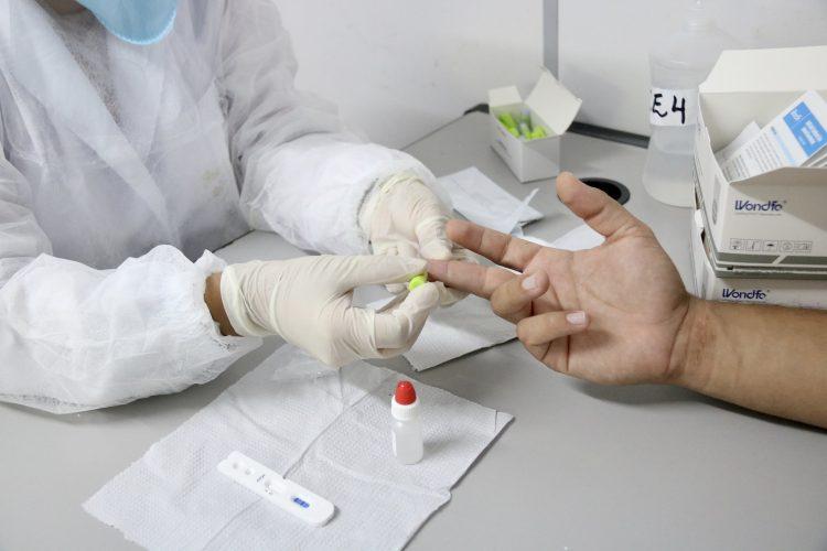 RN tem 98 leitos críticos para tratamento de Covid-19 disponíveis