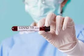 Covid-19: 113.358 mil mortes e mais de 3,5 milhões de infectados no Brasil