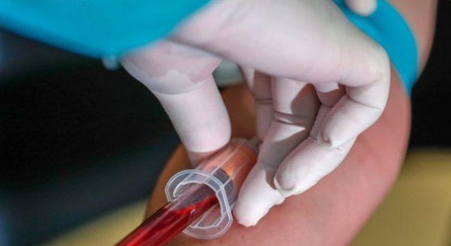 Estudo brasileiro avalia potencial do uso de 4 drogas no tratamento da Covid-19
