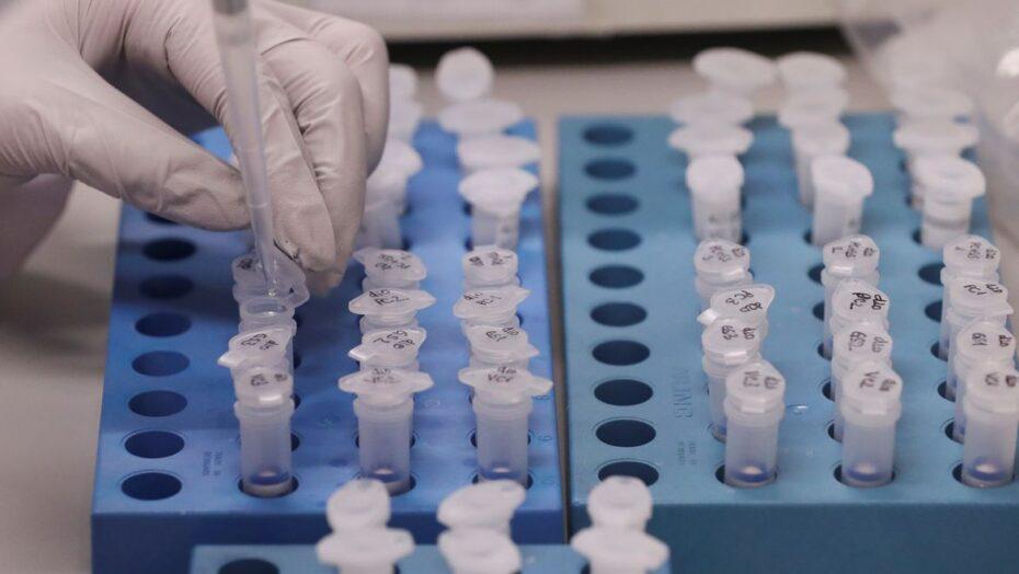 Reinfecções pelo novo coronavírus criam dúvidas sobre imunidade