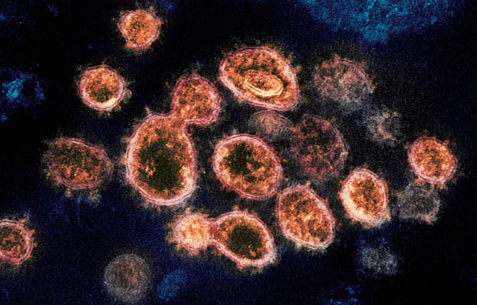 Risco de morrer por Covid aumenta quando a quantidade de vírus é maior no organismo, apontam estudos