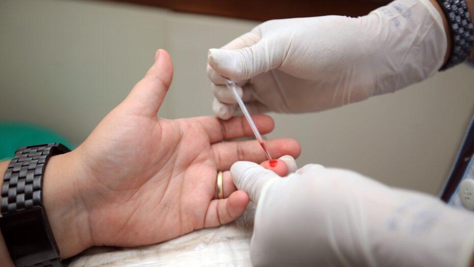 Cura espontânea do HIV é identificada em paciente de 66 anos nos EUA