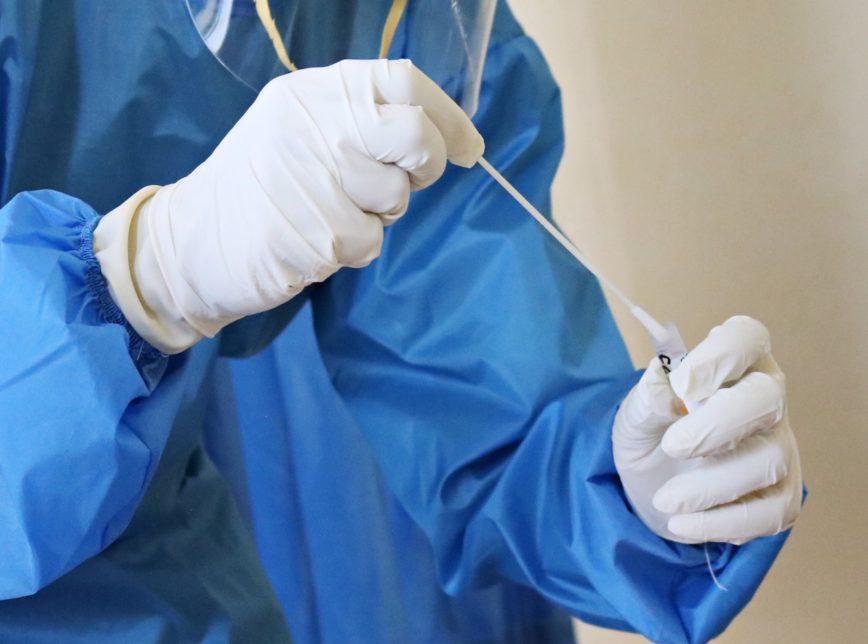 REINFECÇÃO DE COVID-19 É IMPROVÁVEL POR PELO MENOS SEIS MESES, APONTA ESTUDO