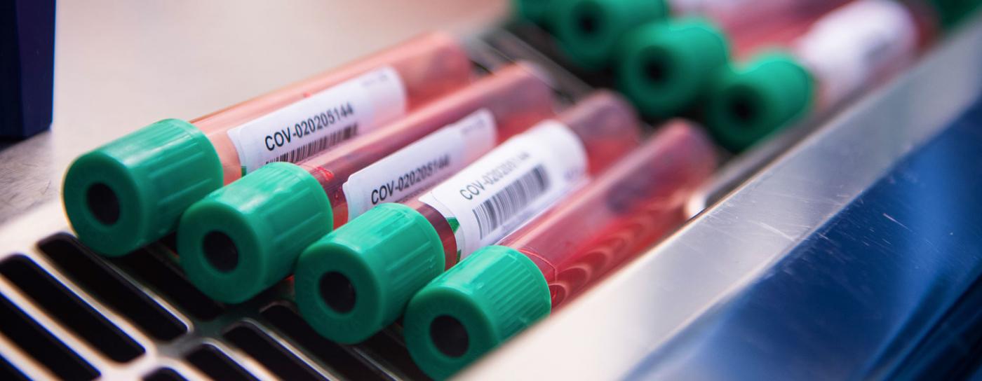 53.347 novos casos e 770 óbitos por covid-19 foram registrados no Brasil em 24 horas