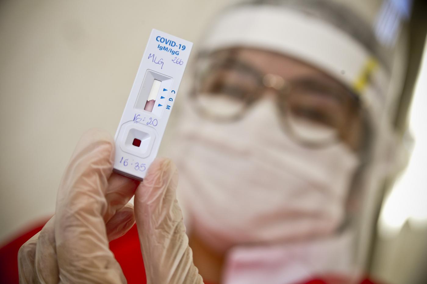 RN registra mais 1.551 casos e 7 mortes por covid-19