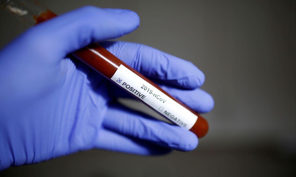 Covid-19: mortes ultrapassam 264 mil e casos chegam a quase 11 milhões