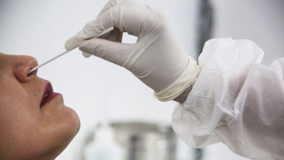 Laboratório público do RN atinge a marca de 150 mil exames de Covid-19 por RT-PCR