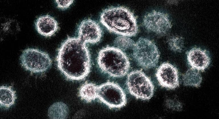 Variante brasileira da Covid-19 é mais transmissível e pode causar reinfecção