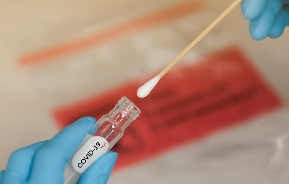 RN confirma mais 820 casos e 29 óbitos por covid-19, sendo 12 em 24 horas