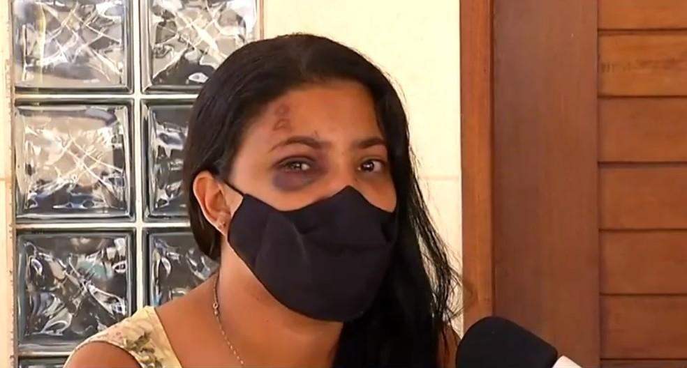 Mulher relata agressões do namorado em festa de aniversário na Grande Natal: 'Ele não pode ficar impune'