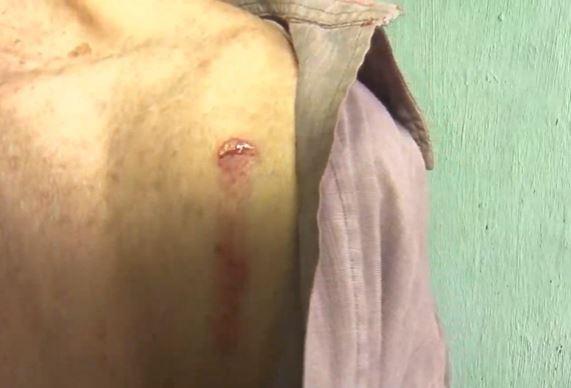 Idosos são espancados durante arrastão no Alecrim; bandido morre em confronto com a PM