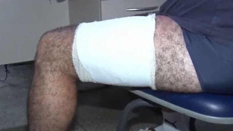 Turista de SP é baleado em tentativa de assalto quando voltava de lagoa na Grande Natal