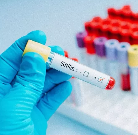 Em 10 anos, RN registra aumento de 1.212% no registro de casos de sífilis; entenda