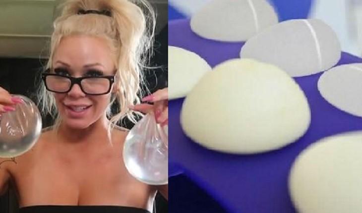 Influencer sente dores, manda remover o silicone dos s€ios e o que encontra dentro das próteses é apavorante
