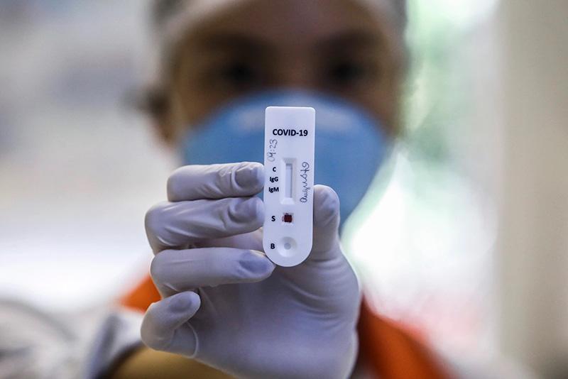 JUNHO REGISTRA AUMENTO DE 747% EM CASOS DE COVID-19 NO RN