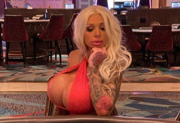 Atriz pornô mostra como está seio após prótese de silicone explodir