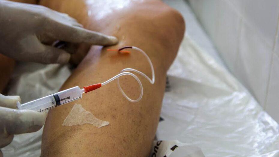 Doença venosa é fator de risco para problemas cardiovasculares