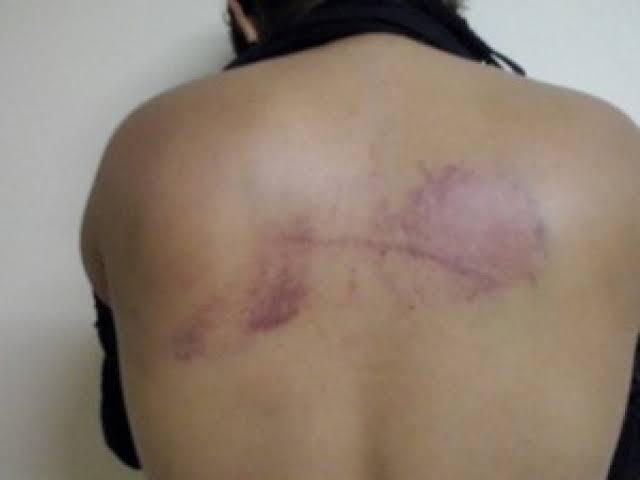 Esposa é espancada após flagrar o marido com amiga pelados na cama