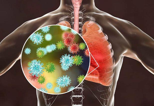 OMS monitora surto misterioso de pneumonia na Argentina