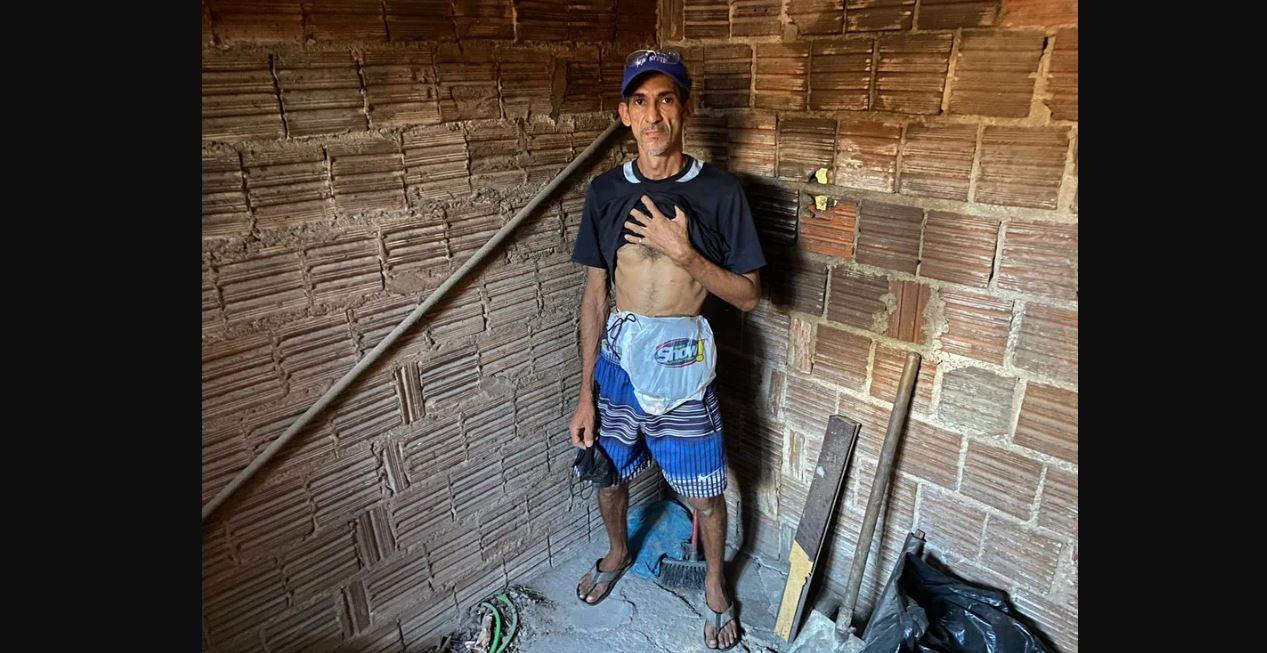 Paciente de Natal que improvisava sacola no lugar de bolsa de colostomia não está em fila para cirurgia por erro do município, diz Sesap-RN