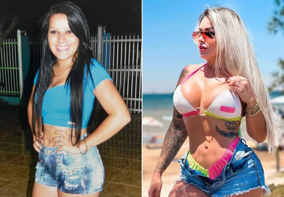 Após R$ 300 mil em plásticas, influencer é atacada e rebate: 