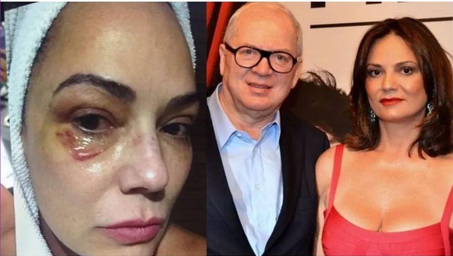 STJ julga se Luiza Brunet teve união estável com empresário; entenda caso de agressão sofrida por modelo