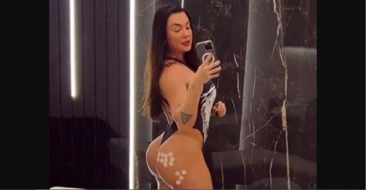 Juju Salimeni faz procedimento estético no bumbum: 