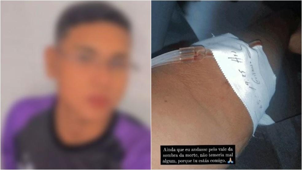 Adolescente é internado após ser atingido por raio dentro de casa no Ceará