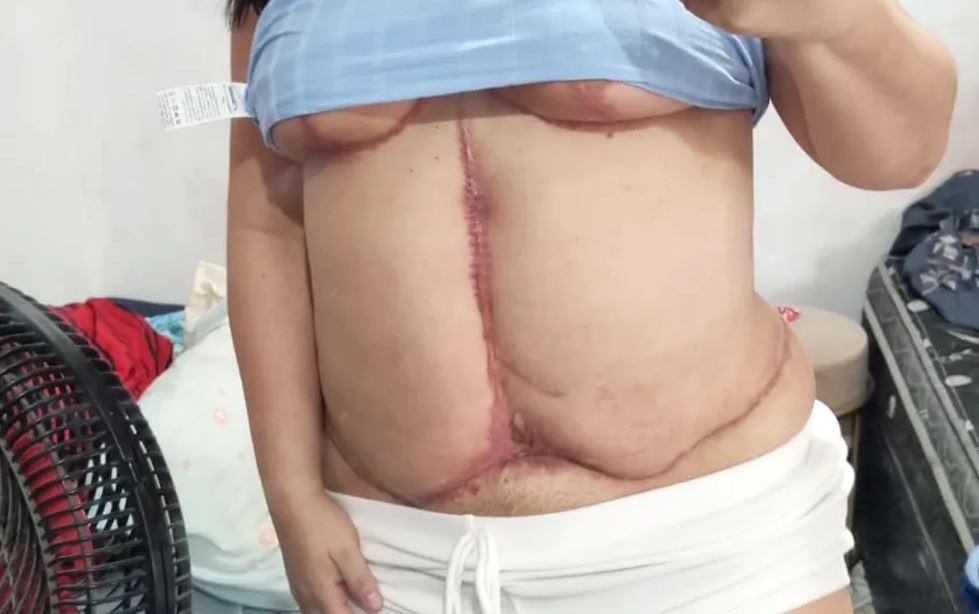 Justiça manda soltar médico equatoriano preso após cirurgia plástica malsucedida