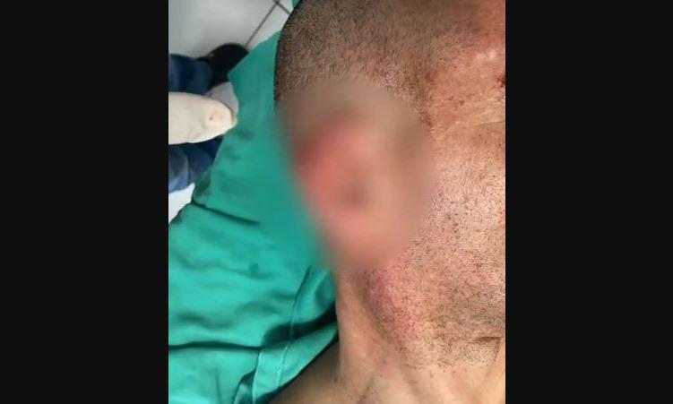 Preso morde e arranca orelha de desafeto durante briga em presídio na Grande Natal