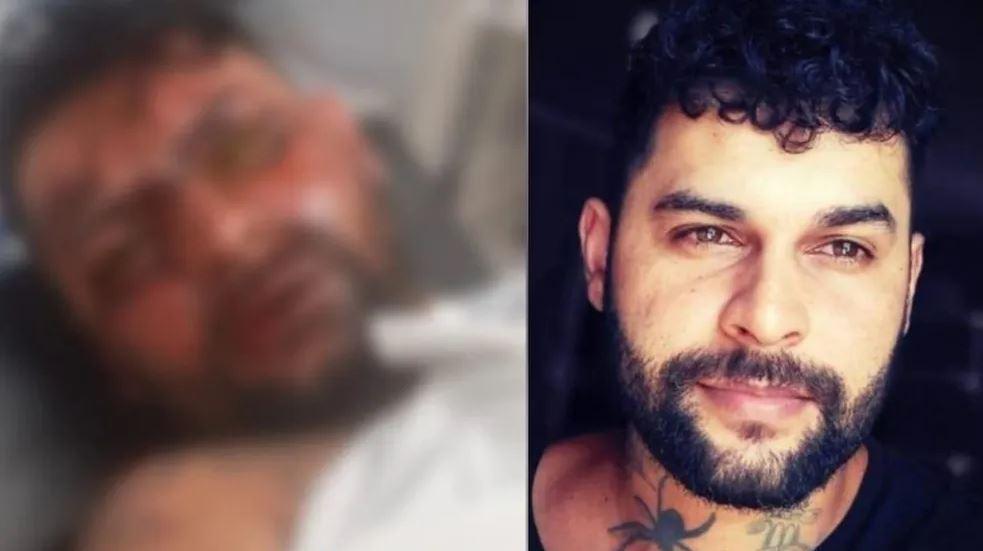 Tatuador fica cego após ex-namorada jogar soda cáustica no rosto dele em saída de academia