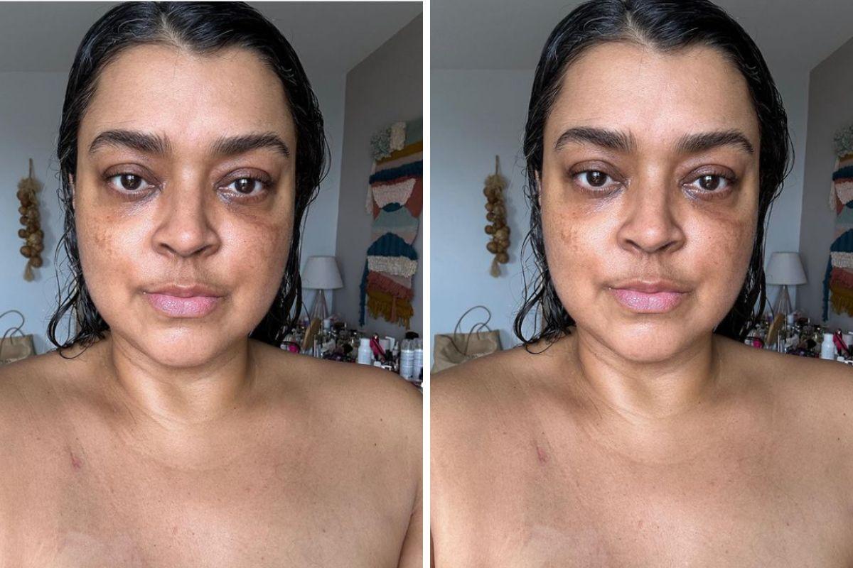 Enxaqueca, pressão alta e perda de sangue: Preta Gil conta primeiros sintomas antes de descobrir câncer