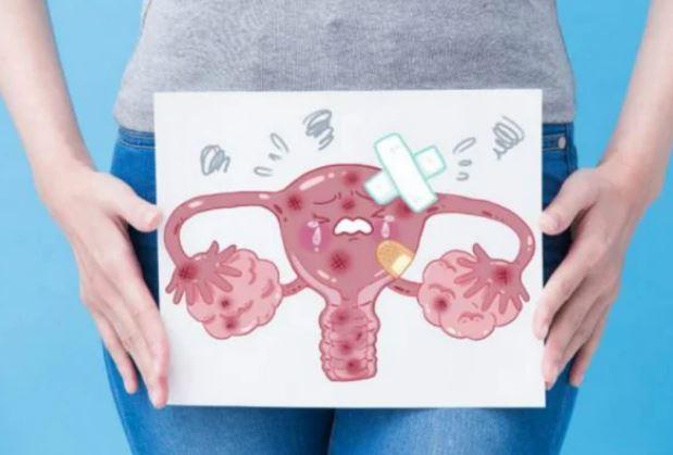 Mulher descobre tumor de 64 quilos no ovário após 15 anos