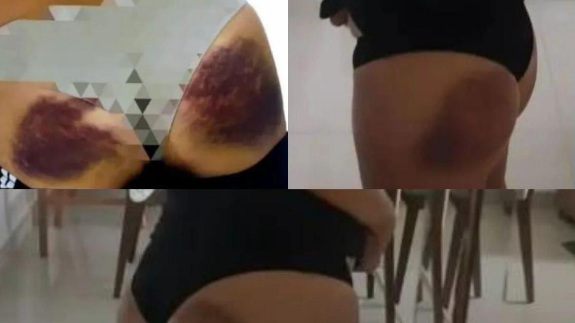 Policial civil do Maranhão é agredida a pauladas por instrutor durante curso tático no Ceará