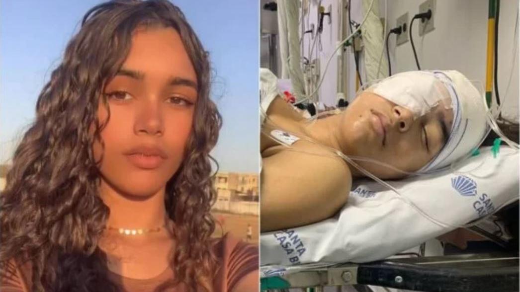 Jovem de 16 anos quase fica cega por sinusite bacteriana; entenda doença e sintomas